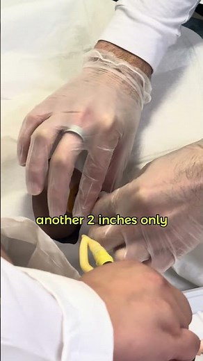 Improve patient care: Male catheter insertion taught by our expert. 📚 #ClinicalPractice #howto