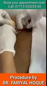 34K views · 145 reactions | A giant skin tag surgery done by Dr Fariyal Hoque......... | Dr. Fariyal Hoque Dermatologist | Facebook