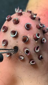 504K views · 441 reactions | Extremely plucking Facial Cleaning And Remove, How is a Lovely video 2025 11 30 12 37 39 | Amy August | Facebook