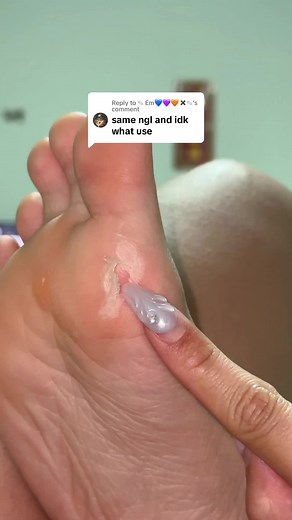 Replying to @✎ Em💙💜🧡✖️✎ crusty feet gang 😀 #feet #feetcare #footfile #skincare #skincarehacks #skincaretools
