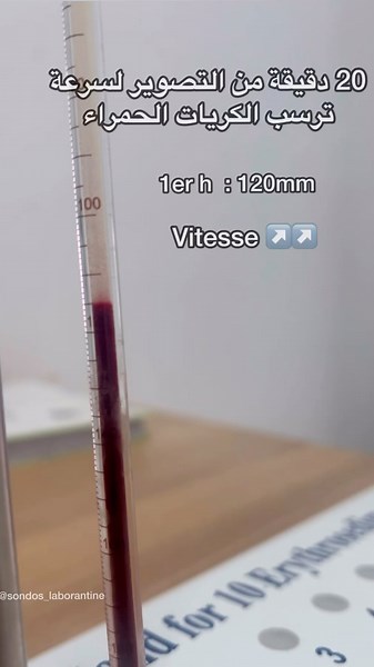 Sondos | Laborantine | 離✨ on Instagram: "Vitesse de sédimentation ↗️"