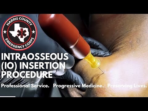 Intraosseous (IO) Insertion Procedure