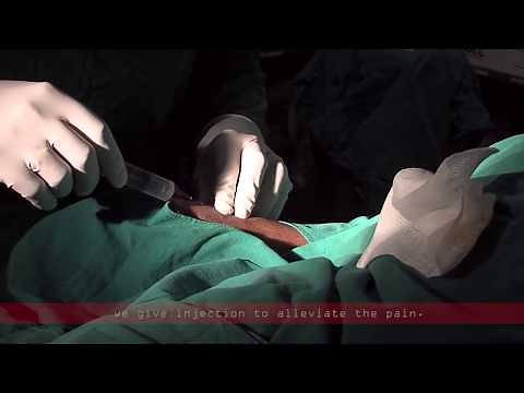 Coronary angiogram | a live demonstration