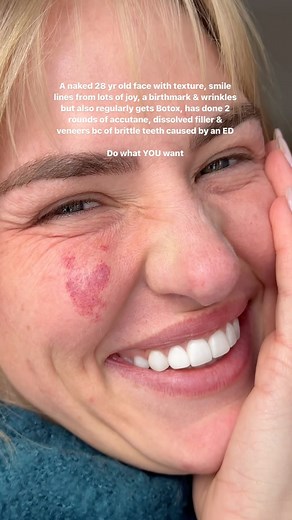 Normalize Normal Bodies AND bodily autonomy 🫶🏻 #normalizenormalbodies | Mik Zazon