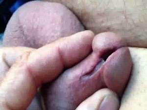 Self Meatotomy Clamping | Anybunny.org