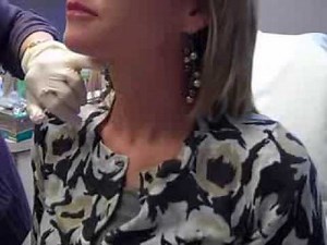 Botox for Neck Muscles Demonstration With Dr. Beth Hagberg