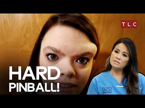 A Patient Grew Her Own Pinball! - Dr Pimple Popper TLC