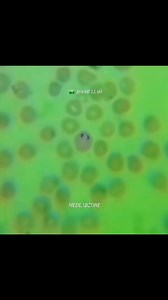 Malarial Parasite Under Microscope 🔬 #highlightsシ゚ #foryoupagereels #viralreelsfb #newviralreelsvideo #viralreelsfacebook #viralreelschallenge #fluidexamination #tiktokviral #views1m #instagramreels #malaria #microscope #mlt #todaybestvideo #viralvideo #viralreels #parasitology #microscopy #tiktokviral #viralreelsfb @topfans MED LAB ZONE Abdul Halim SaMrr Alii RoseApple Darathorn | MED LAB ZONE