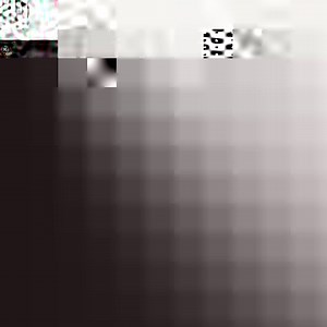 Sliding sign The loss of the normal sliding sign is a dynamic sonographic sign performed during transvaginal ultrasound (TVS) of women with suspected pelvic peritoneal endometriosis. It indicates pouch of Douglas (POD) involvement and obliteration and is suggestive of deep infiltrating endometriosis (DIE). This technique involves using gentle probe pressure to assess whether the anterior rectum and sigmoid colon glides freely across the posterior aspect of the upper uterus, cervix and vaginal wa