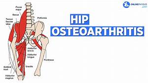 How To Manage Osteoarthritis Of The Hip Osteoarthritis Physical