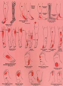 Top Foot Diagnosis Chart