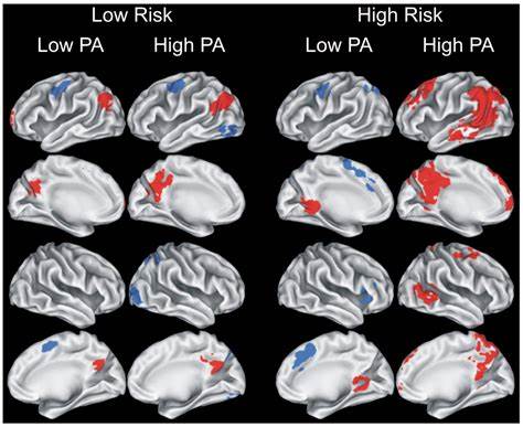 Individuals in danger of Alzheimer's show modified mind capability