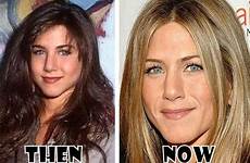 jennifer aniston surgery plastic job before nose botox after celebrity true jen facelift admits boob look young old extreme women