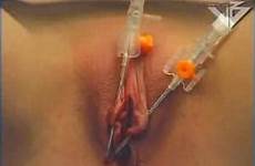 torture bdsm pussy extreme tit pain tg needle avi mb