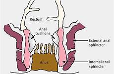 anal incontinence faecal cushions canal sphincters bmj adults open management