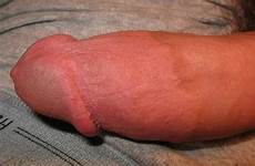 circumcised intact vs disturbing penis frenulum sensitive most lrg ejaculations observation without looks missing