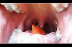 vore goldfish swallow thisvid videos likes ago years