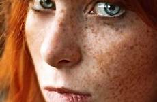 freckled girls beautiful