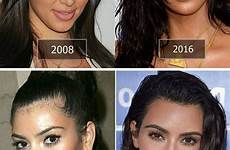kim kardashian before surgery after plastic face visit skin