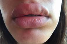 lips big always better not injections juvederm biglips happen let don orange