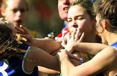 fist erupts janine eastgate aussie snaps