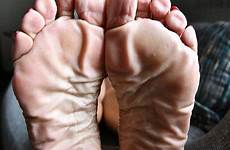 soles feet wrinkles yooying