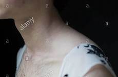 chest hairy hair stock alamy body feminine wearing dress close teenager person