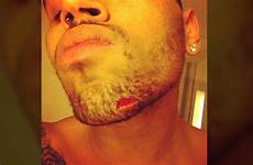 chris brown instagram his rihanna injury fight gash half inch breezy did chin punk bruise cnn appeared corner left posted