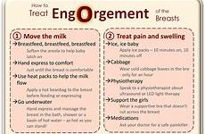 engorgement breastfeeding milk treat breast few days infographic baby hardest