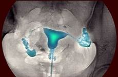reproductive organs imaging
