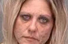 face eyes woman circles dark meth heroin addicts scabs after under drug faces abusing looks her signs does ill evident