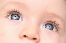 eyes gaze discharge snot healthy nasal safely facty bounty predict kurier babys knack sadly grasped grabbing