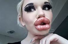 lips biggest lip world injections goes pouty fillers andrea viral getting after woman via instagram ivanova