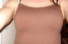 breast realself augmentation