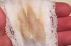 discharge gross smell burn itch had husband