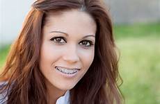 adult braces orthodontics understanding