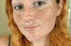 freckles lips freckledgirls