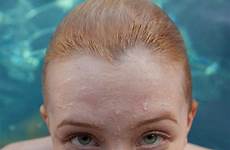freckled zishy redheads lightly freckles noodles