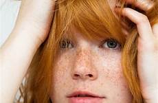 freckles ginger redheads sollis mia sommersprossen haare pelirroja rote pecas freckle rotblonde