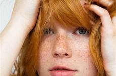 freckles sommersprossen haare redheads sollis rotblonde rote presenting pelirroja pecas rothaarige sexy freckle