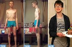 anorexic male death life british his sm living