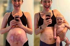 pregnant pregnancy belly bump gesundheit muhalifhaberim