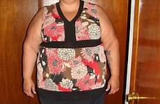 mother obese weight her mum skin wendy rid get now therapy removal chance 2nd illinois life but epperly miller after