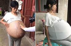belly grows 44lbs thai mysterious mail