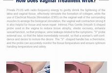 vaginal rejuvenation tightening female machine invasive rf non after before private care