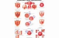 female anatomy genitalia external pathology chart anatomical reproductive disorders visual
