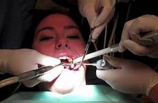 filling tooth dentists office