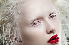 albino albinas albinos nastya showman greatest modelo blancas chicas блондинка face yahoo bellas кожа источник pale