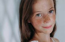 freckles freckled closeup stocksy liliya rodnikova