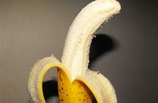 disease penis peyronie curved men risk causes curvature banana cancer higher peyronies if these has makes penises abnormal
